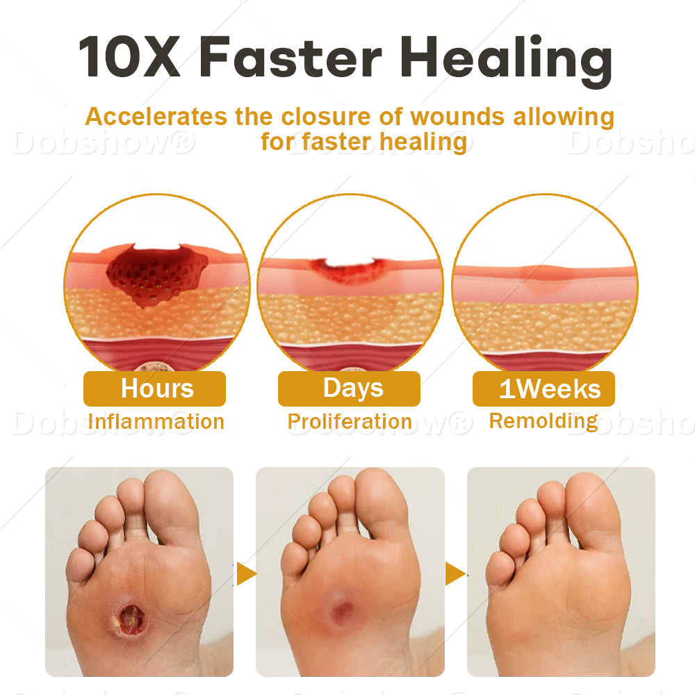 (🔥Last Day Promotion)🔥Healrize®GlucoShield Bee Venom Wound Spray💪