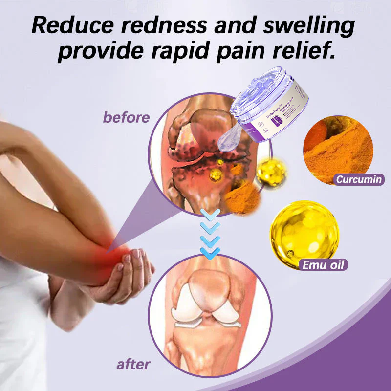 Dobshow®  Joint Pain Treatment Gel  – Turmeric Extract&Emu Oil