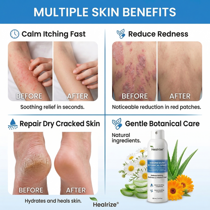 🔥Healrize® Magnesium Botanical Spray – ✅FDA Certified| Advanced Skin Recovery for Psoriasis & Eczema | Rapid Soothing, Steroid-Free