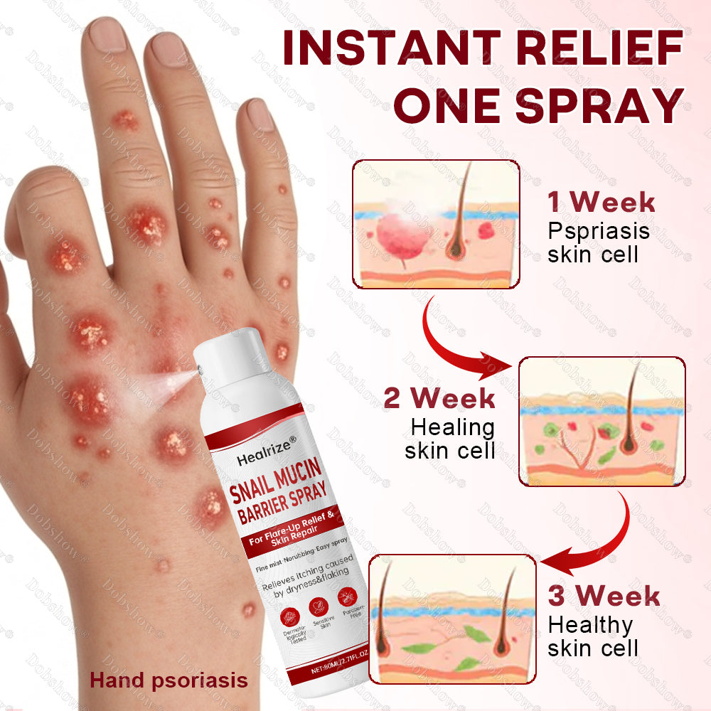 💥March Special Offers| Healrize® Snail Mucin Barrier Spray for Flare-Up Relief & Skin Repair