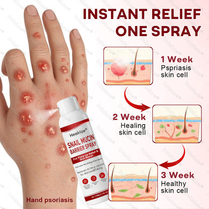 💥March Special Offers| Healrize® Snail Mucin Barrier Spray for Flare-Up Relief & Skin Repair