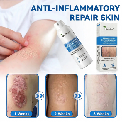 🔥Healrize® Magnesium Botanical Spray – ✅FDA Certified| Advanced Skin Recovery for Psoriasis & Eczema | Rapid Soothing, Steroid-Free